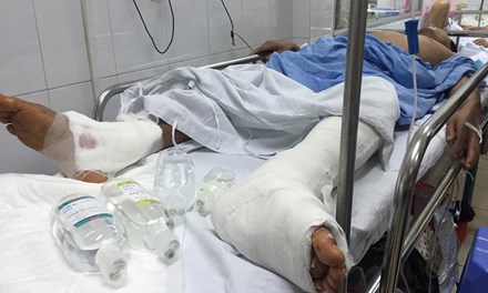 
Bệnh nhân Thảo đang được điều trị tại BV Việt Đức
