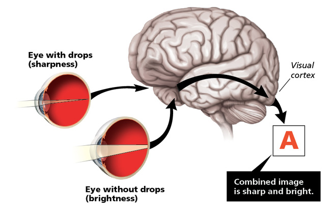 
Não bộ tự phối hợp hình ảnh của hai mắt.
