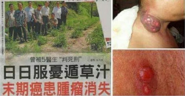
Báo của người Hoa đăng ảnh bệnh nhân bị ung thư nhờ uống nước ép lá bìm bịp mà thoát chết (Ảnh Internet)
