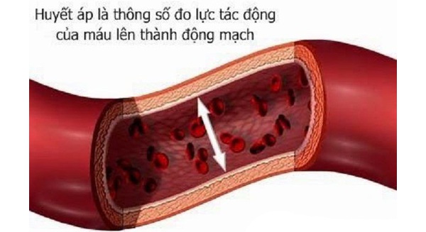 Báo động: 48% người Việt Nam mắc bệnh tăng huyết áp