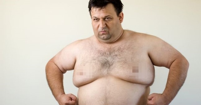 
Chứng ngực to ở nam giới cực kì phổ biến, đặc biệt là ở thiếu niên và người bị béo phì.
