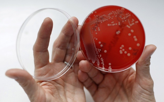 
Hi vọng vẫn luôn tồn tại trong cuộc chiến với siêu vi khuẩn kháng kháng sinh của nhân loại
