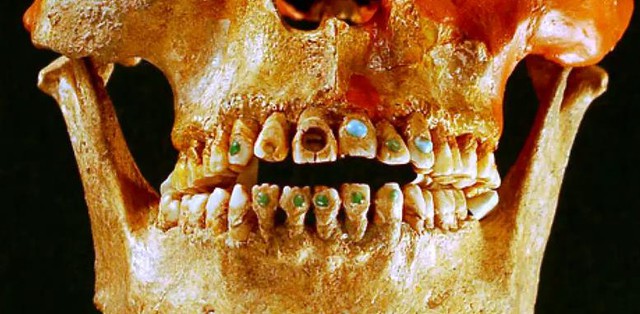 Ngày nay, khoa học và công nghệ hiện đại cho phép con người làm đẹp răng bằng nhiều cách, ngay cả việc thay răng mới, trồng răng vàng, răng bạc.