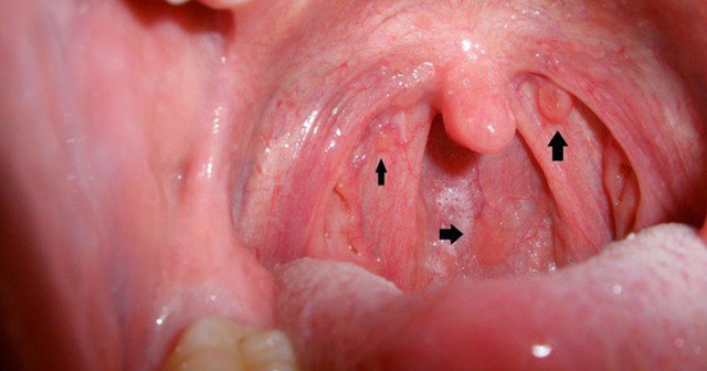 Bỏ thói quen Oral đi nha anh em