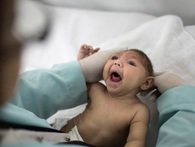 Xuất hiện 2 trường hợp mắc chứng đầu nhỏ do virut Zika đầu tiên ở Đông Nam Á Xuất hiện 2 trường hợp mắc chứng đầu nhỏ do virut Zika đầu tiên ở Đông Nam Á