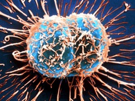 Tế bào ung thư rất "láu cá", chúng giả vờ nhiễm virus để tự mạnh lên và kháng thuốc điều trị Tế bào ung thư rất "láu cá", chúng giả vờ nhiễm virus để tự mạnh lên và kháng thuốc điều trị