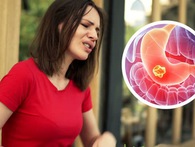 Cẩn trọng với căn bệnh ung thư dễ mắc nhất ở cả nam và nữ tại Việt Nam Cẩn trọng với căn bệnh ung thư dễ mắc nhất ở cả nam và nữ tại Việt Nam