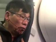 Cổ phiếu United Airlines "hồi sinh” sau bê bối đẩy khách gốc Việt khỏi máy bay Cổ phiếu United Airlines "hồi sinh” sau bê bối đẩy khách gốc Việt khỏi máy bay