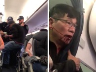 Cổ phiếu lao dốc, CEO United Airlines lần thứ 2 xin lỗi vụ bác sĩ gốc Việt bị đá khỏi máy bay Cổ phiếu lao dốc, CEO United Airlines lần thứ 2 xin lỗi vụ bác sĩ gốc Việt bị đá khỏi máy bay