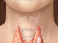 Ai dễ bị ung thư tuyến giáp? Ai dễ bị ung thư tuyến giáp?