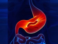 7 dấu hiệu nhỏ nhưng đừng bỏ qua vì chúng đang cảnh báo dạ dày lá lách bị tổn thương 7 dấu hiệu nhỏ nhưng đừng bỏ qua vì chúng đang cảnh báo dạ dày lá lách bị tổn thương