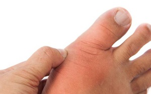 8 loại thực phẩm không tốt cho bệnh nhân gút: Chỉ cần chớm bệnh đã phải hạn chế ăn nhiều 8 loại thực phẩm không tốt cho bệnh nhân gút: Chỉ cần chớm bệnh đã phải hạn chế ăn nhiều