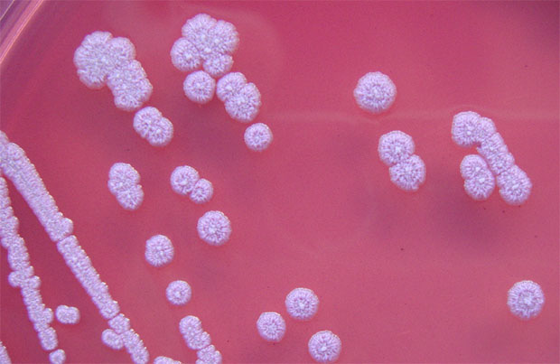 Bệnh vi khuẩn ăn thịt người Whitmore gia tăng đột biến ở miền Trung - Ảnh 1.