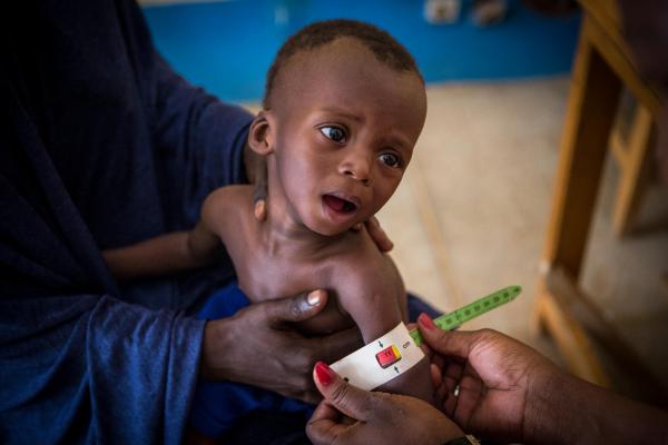 UNICEF cảnh báo 6,7 triệu trẻ em dưới 5 tuổi bị còi xương năm 2020 do dịch Covid-19 - Ảnh 3.