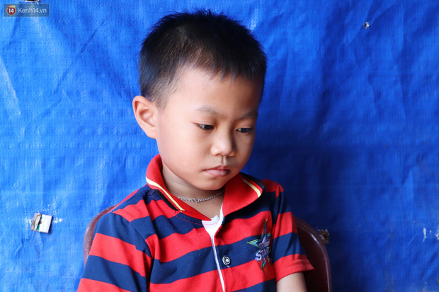 Lời khẩn cầu của bé trai 8 tuổi mắc bệnh lạ, phải cắt bỏ ruột: Mỗi lần chảy máu nó bắn ra ngoài, con sợ lắm… - Ảnh 2. Lời khẩn cầu của bé trai 8 tuổi mắc bệnh lạ, phải cắt bỏ ruột: Mỗi lần chảy máu nó bắn ra ngoài, con sợ lắm… - Ảnh 2.
