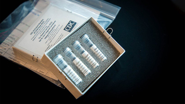 Công ty Mỹ giới thiệu bộ thử kháng thể đối với Covid-19 - Ảnh 1.