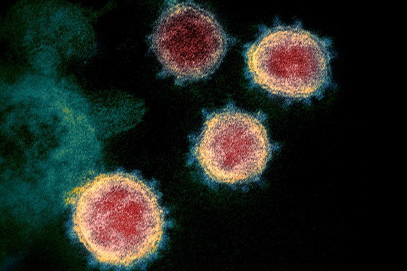Con người sẽ không thể tự miễn dịch với virus SARS-CoV-2? - Ảnh 1.