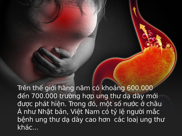  3 dấu hiệu bất thường ở bàn tay cho thấy dạ dày đang kêu cứu, ở độ tuổi nào cũng cần làm ngay 4 việc để ngăn cản ung thư hình thành  - Ảnh 1.