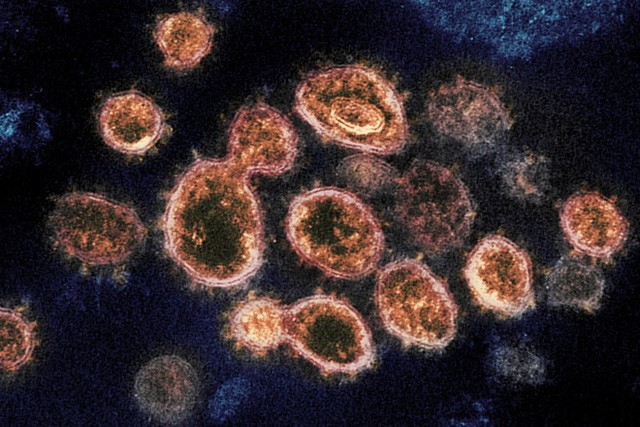 Biến thể của SARS-COV-2 gây triệu chứng nhẹ tại Singapore - Ảnh 1.