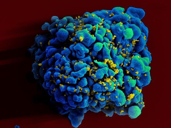 Người đầu tiên trên thế giới tự khỏi HIV mà không cần điều trị - Ảnh 2.