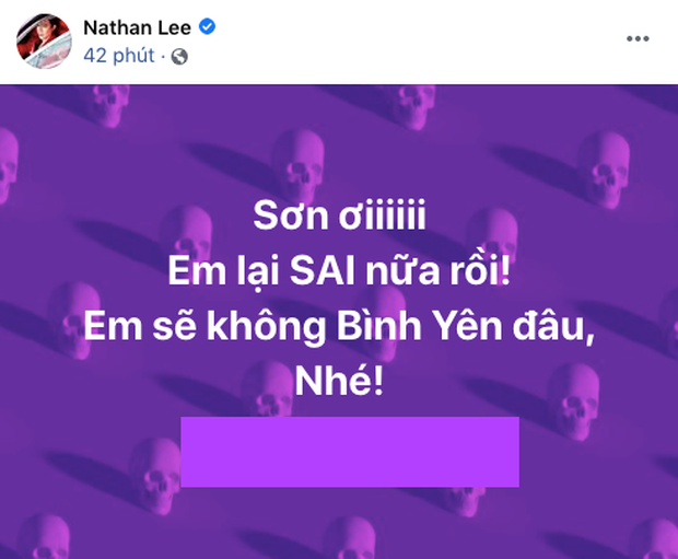  1 ngày trước khi bị Nathan Lee thách thức, Cao Thái Sơn ngang nhiên hát live 2 bản hit dù đã bị mua độc quyền vĩnh viễn?  - Ảnh 1.