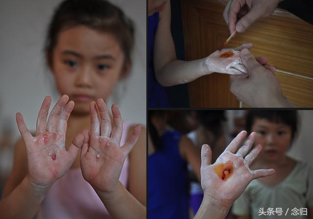 Giấc mơ vô địch Olympic của những đứa trẻ ở lò đào tạo thể thao Trung Quốc: Đánh đổi tuổi thơ bằng máu, mồ hôi và nước mắt  - Ảnh 7.