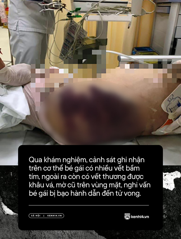  Toàn cảnh vụ bé gái 8 tuổi bị bạo hành, tử vong ở TP.HCM: Lạnh người trước lời khai vô cảm của dì ghẻ và hình ảnh hiện trường đầy xót xa - Ảnh 3.