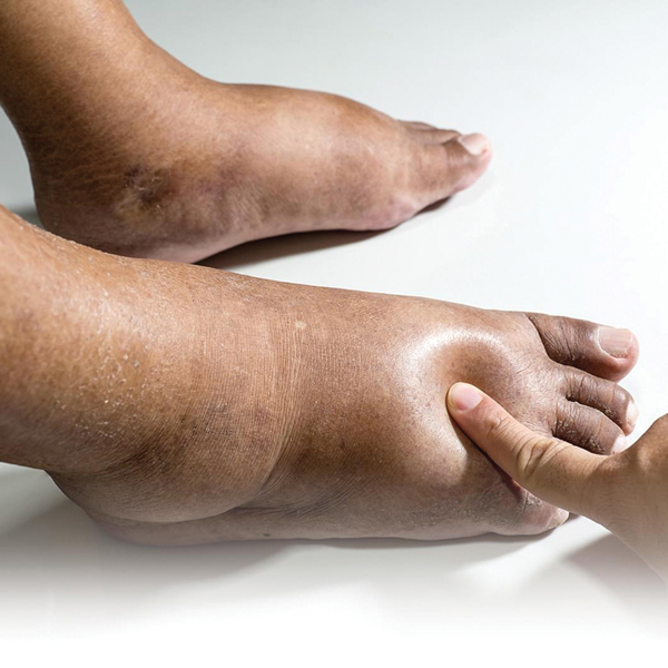  6 vị trí đau chân này là “manh mối” của các loại bệnh khác nhau: Nhẹ thì đau nhức xương khớp do thời tiết, nặng có lẽ bệnh tiểu đường đang đến rất gần, nhất định không được xem nhẹ  - Ảnh 2.