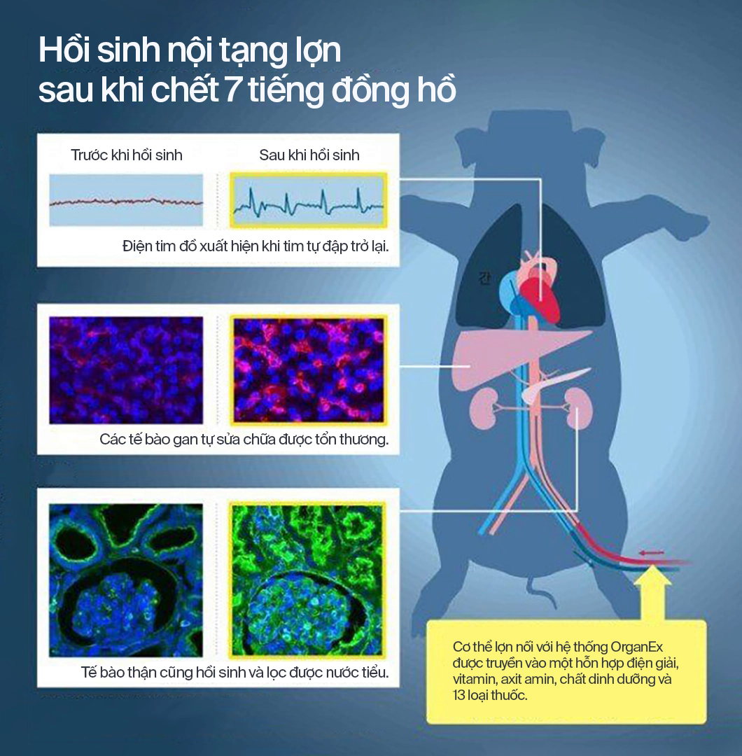 Với những cỗ máy hồi sinh, các nhà khoa học đang định nghĩa lại cái chết - Ảnh 13.