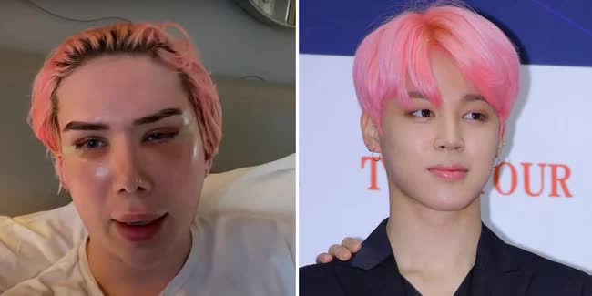 32 lần dao kéo để giống Jimin BTS nhưng thất bại, chàng trai hối hận mong ước được quay về với gương mặt cũ - Ảnh 4.