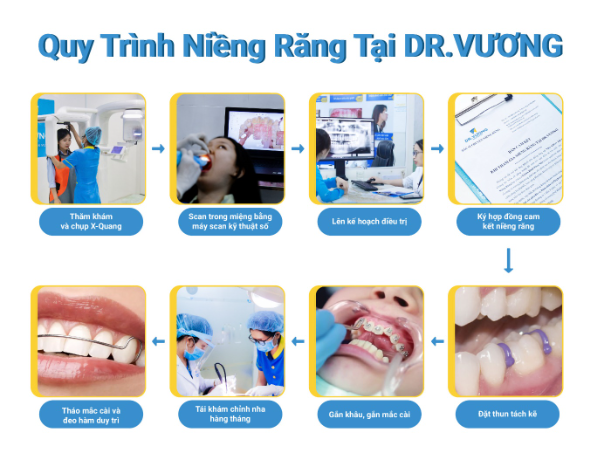 Niềng răng trả góp theo ngày tại nha khoa Dr. Vương - Ảnh 3.