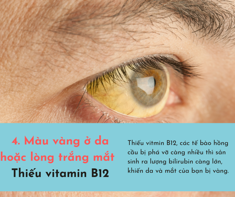 Cơ thể bị &quot;cạn kiệt&quot; vitamin sẽ phát ra 6 dấu hiệu, chủ quan bỏ qua có thể sẽ tổn thọ  - Ảnh 4.