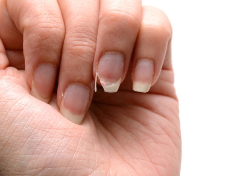 Xem tay có thể tiết lộ tình trạng sức khỏe - Ảnh 6. Xem tay có thể tiết lộ tình trạng sức khỏe - Ảnh 6.