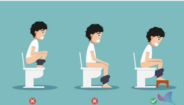 Khi đi vệ sinh, ngồi bệt hay ngồi xổm tốt hơn cho sức khỏe: Sai lầm 75% người đang mắc phải đang khiến bệnh trĩ, táo bón thường xuyên ghé thăm - Ảnh 2.