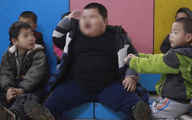  Cậu bé 6 tuổi chỉ ăn đồ hấp luộc để giảm cân, không ngờ sau 1 năm nặng tới 80kg và bị gan nhiễm mỡ, bác sĩ nghe thực đơn liền lắc đầu ngao ngán - Ảnh 1.