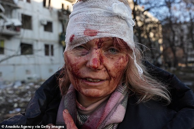  Người phụ nữ biểu tượng về sự tàn phá ở Ukraine: Hình ảnh before - after gây khắc khoải - Ảnh 1.