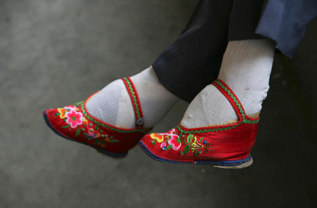 Hình ảnh của những đôi chân gót sen cuối cùng tại Trung Quốc: Nhân chứng sống ám ảnh về hủ tục đau thương bậc nhất thời phong kiến - Ảnh 1.