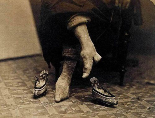 Hình ảnh của những đôi chân gót sen cuối cùng tại Trung Quốc: Nhân chứng sống ám ảnh về hủ tục đau thương bậc nhất thời phong kiến - Ảnh 16.