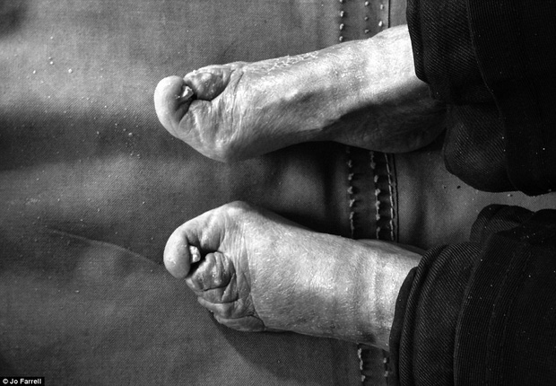 Hình ảnh của những đôi chân gót sen cuối cùng tại Trung Quốc: Nhân chứng sống ám ảnh về hủ tục đau thương bậc nhất thời phong kiến - Ảnh 5.