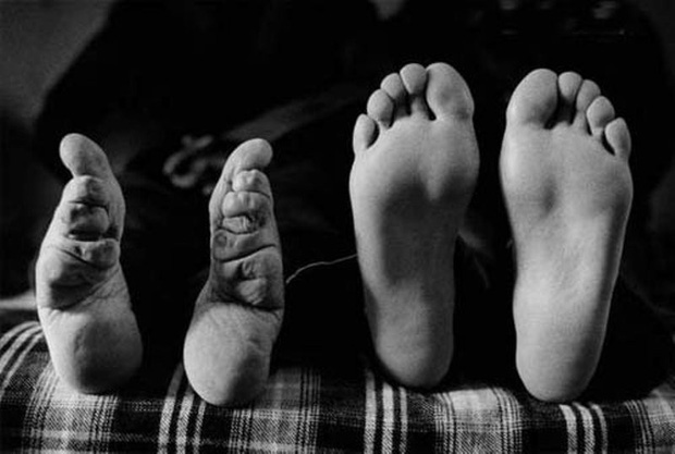 Hình ảnh của những đôi chân gót sen cuối cùng tại Trung Quốc: Nhân chứng sống ám ảnh về hủ tục đau thương bậc nhất thời phong kiến - Ảnh 6.