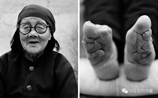 Hình ảnh của những đôi chân gót sen cuối cùng tại Trung Quốc: Nhân chứng sống ám ảnh về hủ tục đau thương bậc nhất thời phong kiến - Ảnh 8.