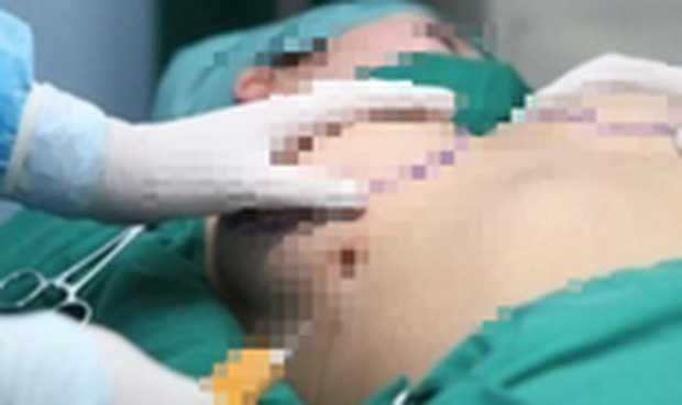 The case of a 61-year-old woman who died after breast augmentation: Saigon Kangnam Cosmetic Hospital spoke up - Photo 1.