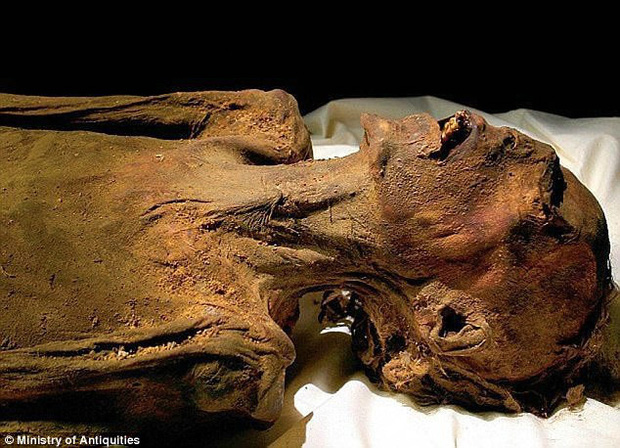 Bí ẩn “xác ướp hoàng tử la hét” 3.000 tuổi với vẻ mặt đau đớn đến ám ảnh: Kết quả phân tích ADN tiết lộ câu chuyện bi thảm đằng sau - Ảnh 2.