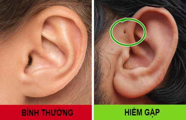  Nếu sở hữu 1 trong 8 đặc điểm này, bạn sẽ thuộc nhóm người đặc biệt nhất trên thế giới - Ảnh 8.