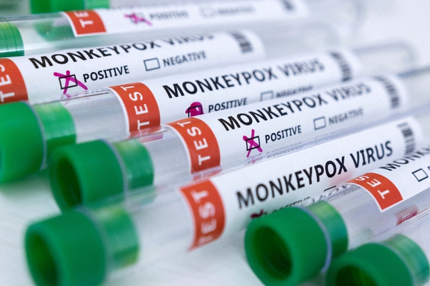  WHO phát hiện virus gây bệnh đậu mùa khỉ trong tinh dịch của bệnh nhân - Ảnh 1.