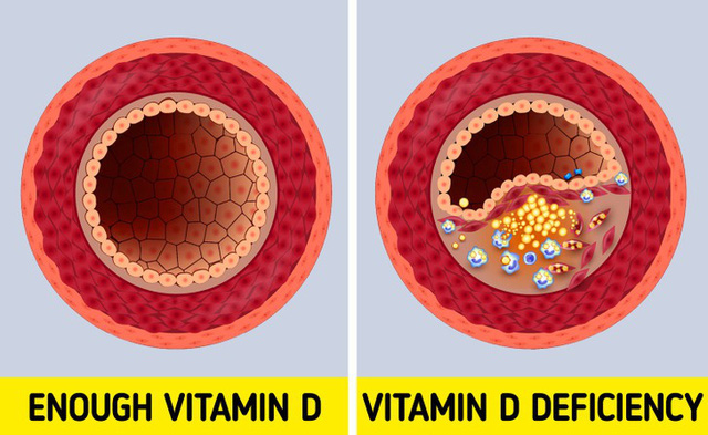 6 dấu hiệu cảnh báo cơ thể bạn đang thiếu Vitamin D trầm trọng - Ảnh 2.