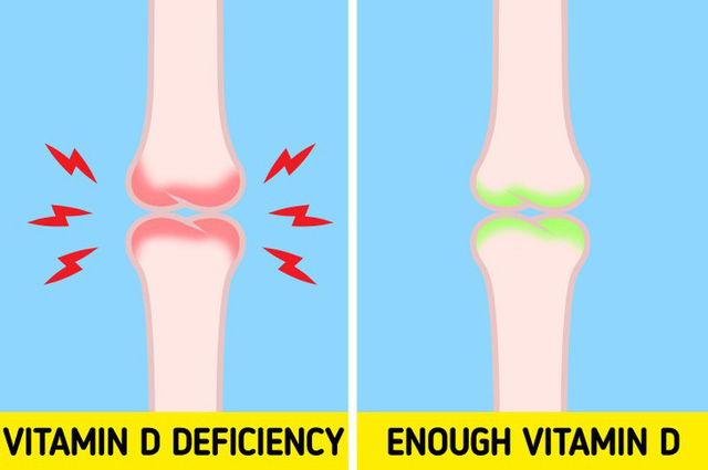 6 dấu hiệu cảnh báo cơ thể bạn đang thiếu Vitamin D trầm trọng - Ảnh 3.