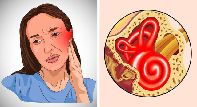 6 dấu hiệu giúp bạn nhận biết đã bị nhiễm trùng tai - Ảnh 2.
