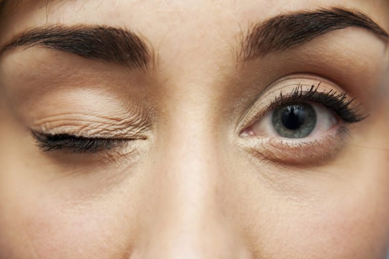 Nhiều người làm động tác này để giảm mỏi mắt mà không biết có thể gây biến dạng nhãn cầu - Ảnh 4.