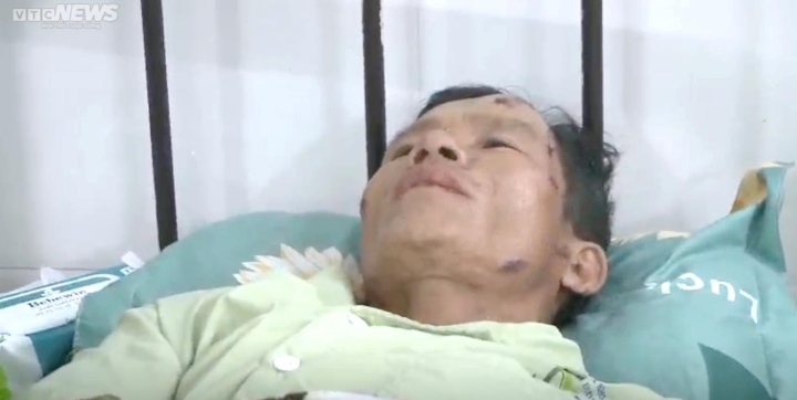 Lời kể của nạn nhân vụ sập tường khiến 11 người thương vong ở Bình Định - Ảnh 1.